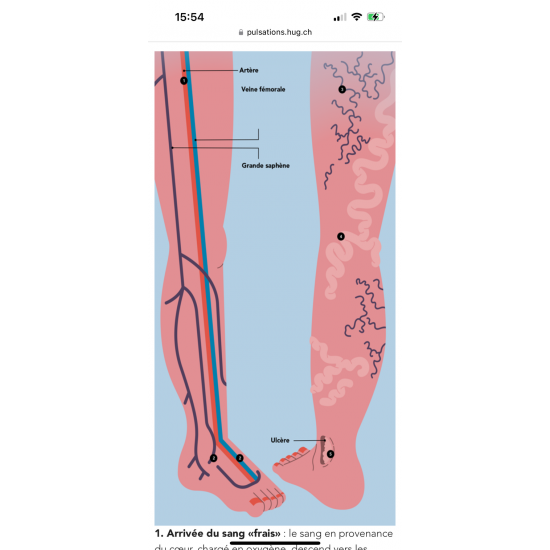 Varices-Cours circulatoire #1 