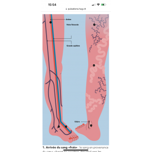 Varices-Cours circulatoire #4