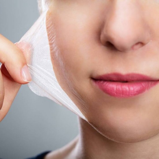 Peeling Chimique