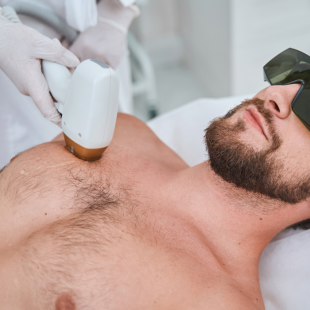 Épilation laser dos OU torse