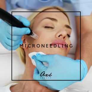Microneedling visage et cou